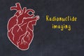 Chalk sketch of human heart on black desc and inscription Radionuclide imaging Royalty Free Stock Photo