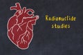 Chalk sketch of human heart on black desc and inscription Radionuclide studies Royalty Free Stock Photo