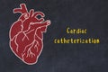 Chalk sketch of human heart on black desc and inscription Cardiac catheterization