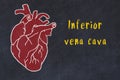 Chalk sketch of human heart on black desc and inscription Inferior vena cava