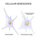 Changes senescent cells During ageing Royalty Free Stock Photo