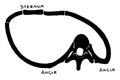 Changes in the Thorax following Scoliosis of the Spine, vintage illustration