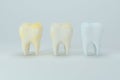 Changing of the tooth color from yellow to white, 3d rendering