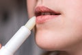 Chapped, or cracked, dry lips that have lost moisture. Woman maintains her lips. Lip Care