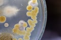 Characteristic of Actinomyces, Bacteria, yeast and Mold on selective media from soil samples for study in laboratory microbiology.