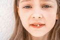 Charming smiling little girl kid with opened mouth shows staggering loose falling out first baby milk front tooth Royalty Free Stock Photo