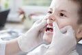 Checking the child`s teeth status. The doctor`s hands in white gloves move the gums and reveal the boy`s white teeth. Royalty Free Stock Photo