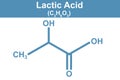 Chemistry illustration of lactic acid in blue Royalty Free Stock Photo