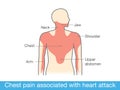 Chest pain associated with heart attack Royalty Free Stock Photo