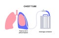 Chest tube catheter