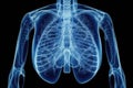 Chest x-ray image of dextrocardia and situs inversus patient that demonstrated heart,lungs,ribs,bones and muscles look like