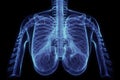 Chest x-ray image of dextrocardia and situs inversus patient that demonstrated heart,lungs,ribs,bones and muscles look like