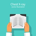 Chest X-ray vector