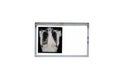 Chest X-rays on negatoscope. Negatoscope isolated on white background. Healthcare and Medical concept Royalty Free Stock Photo