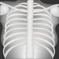 Chest X-rays in upright position for medical study and learning. Easily understand with important structure of thorax, bone, Royalty Free Stock Photo