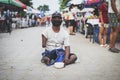 CHIANG MAI, THAILAND - July 5, 2021 : Beggar with crippled arms and legs solicit donations of money and items in the flea market