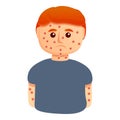 Chicken pox boy icon, cartoon style Royalty Free Stock Photo