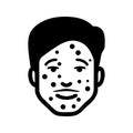 Chickenpox, disease, illness icon. Black vector graphics Royalty Free Stock Photo
