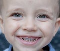 A child with a black hole in her teeth, her teeth in a little smiling boy Royalty Free Stock Photo