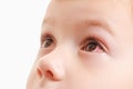 Child conjunctivitis red eye with infection,   illness Royalty Free Stock Photo