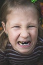 Child with a dental orthodontic device and without one tooth