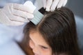 Child Doctor Checking Head Hair Royalty Free Stock Photo