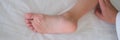 Child foot with flaky skin after burn or coxsackie virus closeup