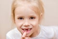 Child girl shows changing milk tooth