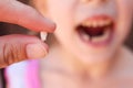 child has lost baby tooth. Royalty Free Stock Photo