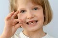 Child, kid, shows the fallen baby tooth. Royalty Free Stock Photo