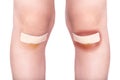 Child knees with a plaster (for wounds) and bruise