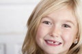 Child missing front tooth Royalty Free Stock Photo