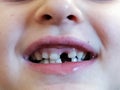Child proud of missing front tooth Royalty Free Stock Photo