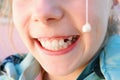 Child pulled out milk tooth with thread