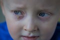 Child with purulent conjunctivitis, contagious eye infection. Symptoms and treatment concept. Close up Royalty Free Stock Photo