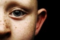 Child's Blue Eye