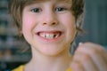 The child's milk tooth fell out. A satisfied boy holds a tooth in his hand. The hole is visible in the gum. Close-up.