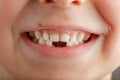 A child`s smile without lower baby teeth. A hole in a child`s smile. Fun concept