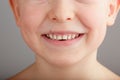 A child`s smile without lower baby teeth. A hole in a child`s smile. Fun concept