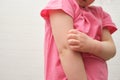 child scratches atopic skin. Dermatitis, diathesis, allergy on the child& x27;s body.irritation and pruritus. Royalty Free Stock Photo