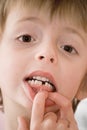 Child showing new tooth