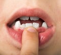 Child shows tooth Royalty Free Stock Photo