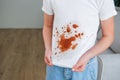 The child spilled coffee on his clothes. The concept of a stain on a t-shirt Royalty Free Stock Photo
