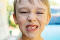 Child teeth close up. The kid dropped the first milk tooth