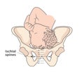 Child in womb - pelvis ischial spines - medical illustration Royalty Free Stock Photo