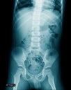 Child x-ray image of human Royalty Free Stock Photo