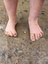 A child muddy feet from spashing in puddles after rain