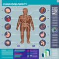 Childhood Obesity And Organs Infographic Set Royalty Free Stock Photo