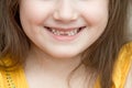 Childish face lower part with missing front lower milk teeth in a smiling mouth Royalty Free Stock Photo