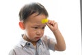 Children have ulcers on the head. Royalty Free Stock Photo